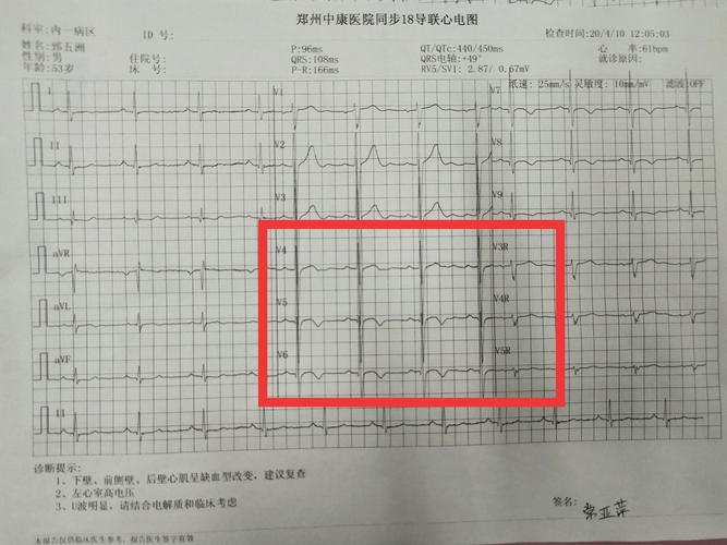 心肌缺血心电图可以看出吗